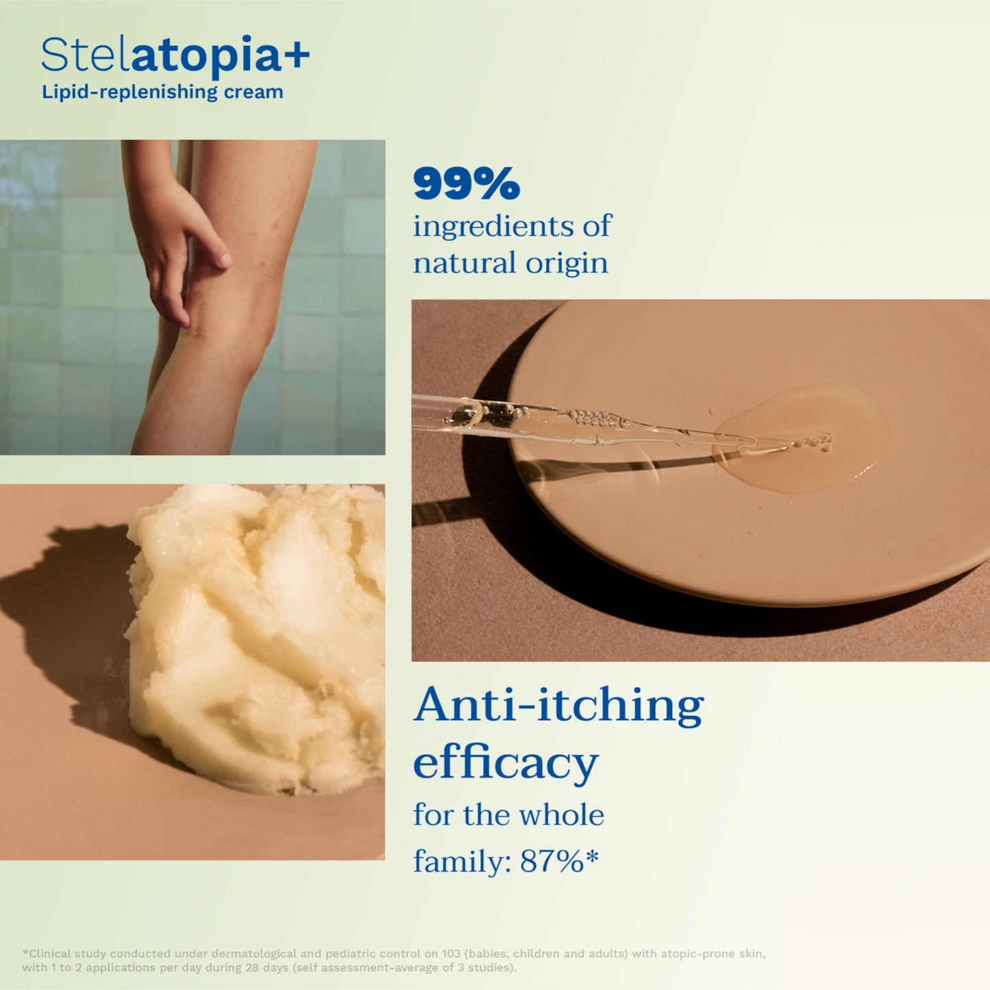 Mustela Lipid-Replenishing Cream, Anti-Itching - 150ml